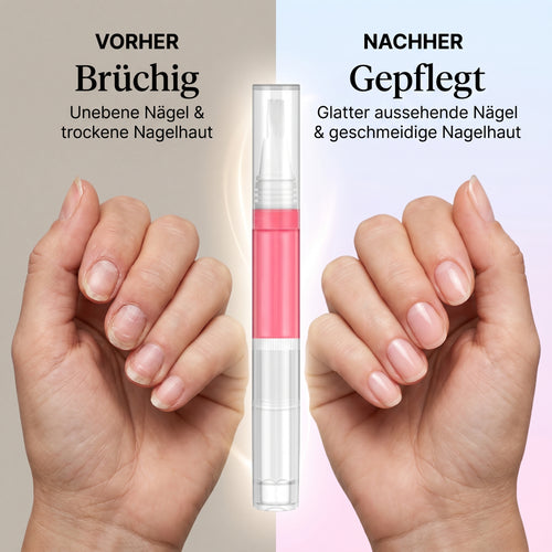 Nagel Wachstums-Stift